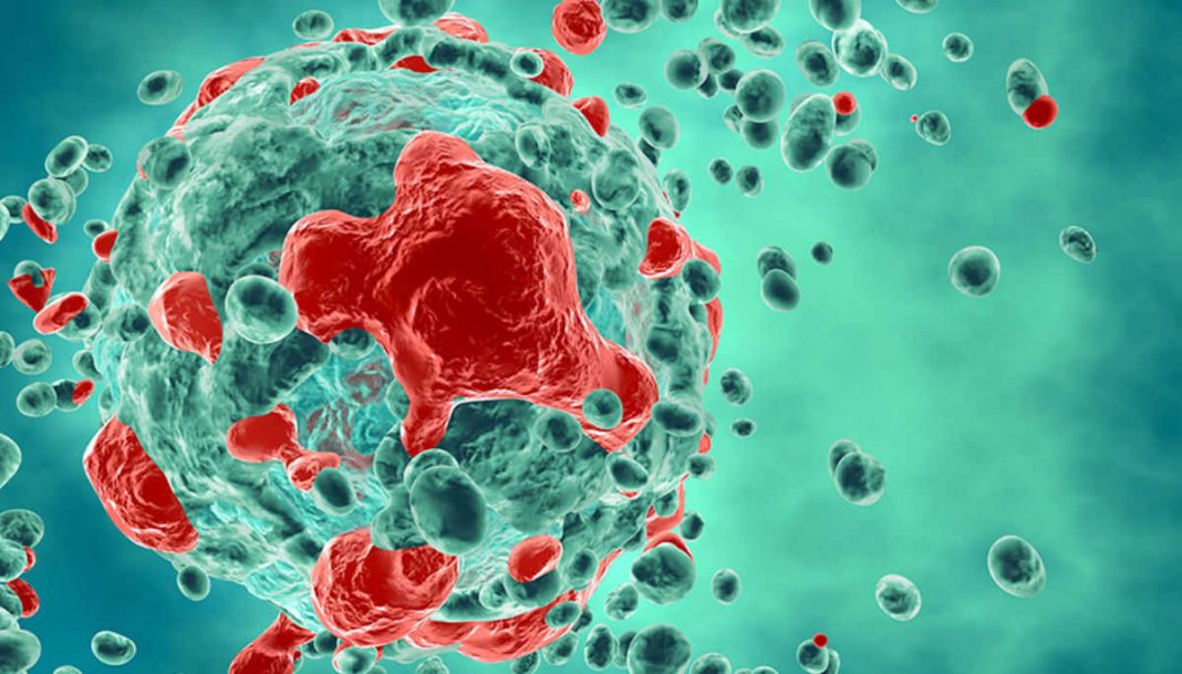cáncer